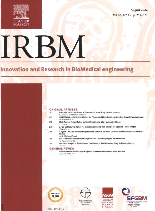 IRBM