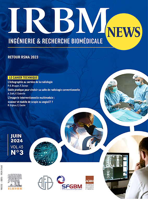 IRBM NEWS